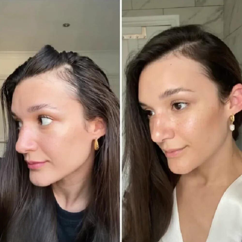 HairGrow™ - Vogany Natürliches Haarwuchsöl (50% RABATT)