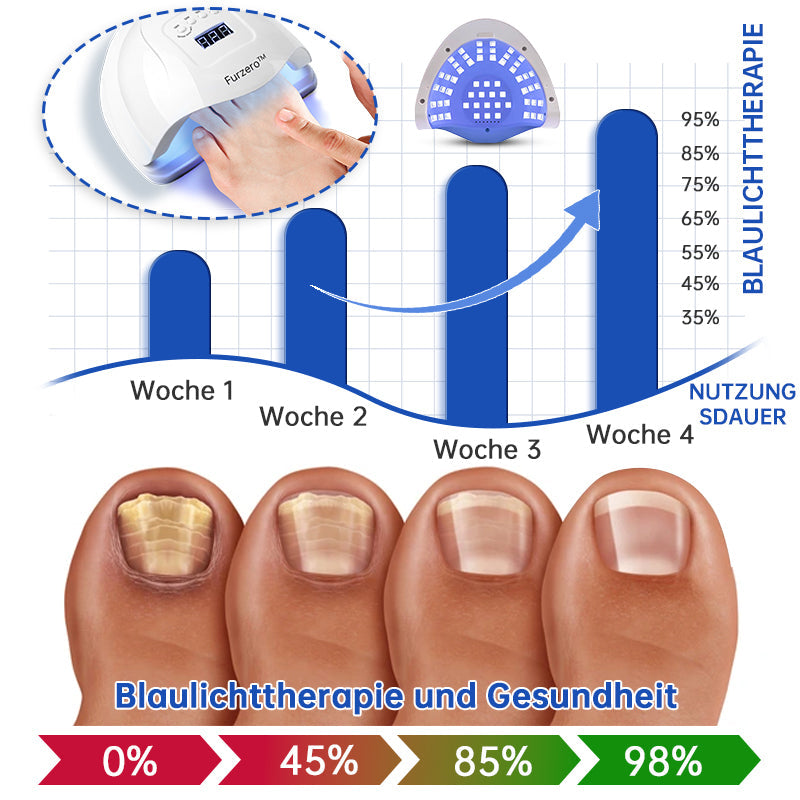 NailCure™ - Nagelpilz-Laserbehandlung Lösung (50% RABATT)