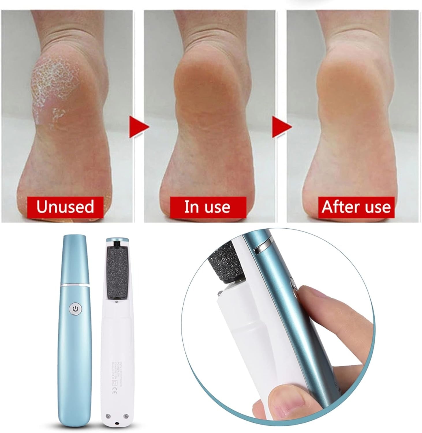 Pedilume™ | Elektrische Fußschleifmaschine Hornhautentferner