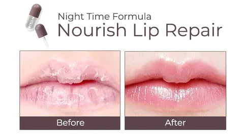 Derol™ - Lip Plumper Kit (50% RABATT)