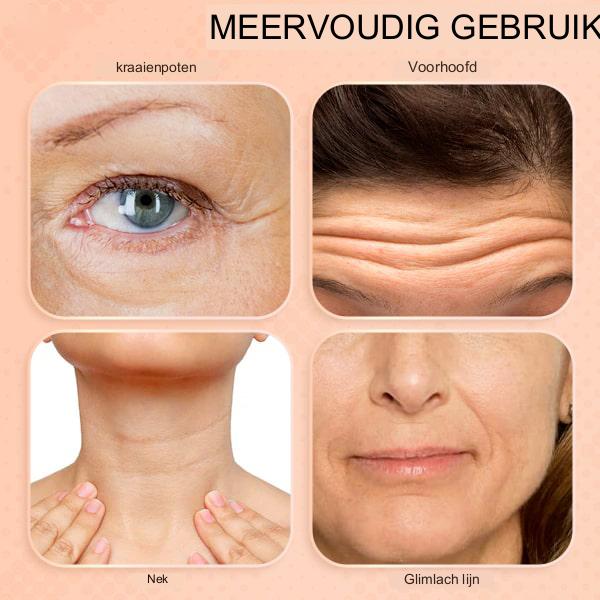 DerolSilky™ - Balsam Zur Faltenentfernung (1+1 GRATIS)