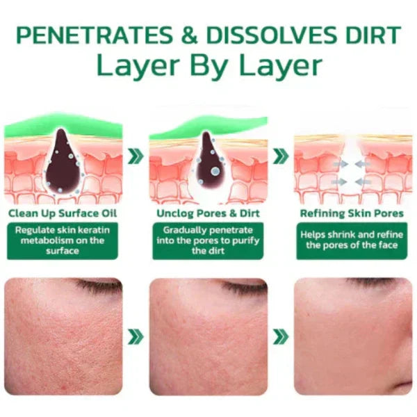 Greenify™ - Original Matcha Tiefenreinigungs-Maskenstift (50% RABATT)