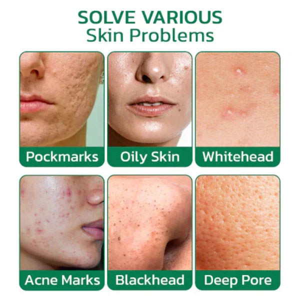 Greenify™ - Original Matcha Tiefenreinigungs-Maskenstift (50% RABATT)