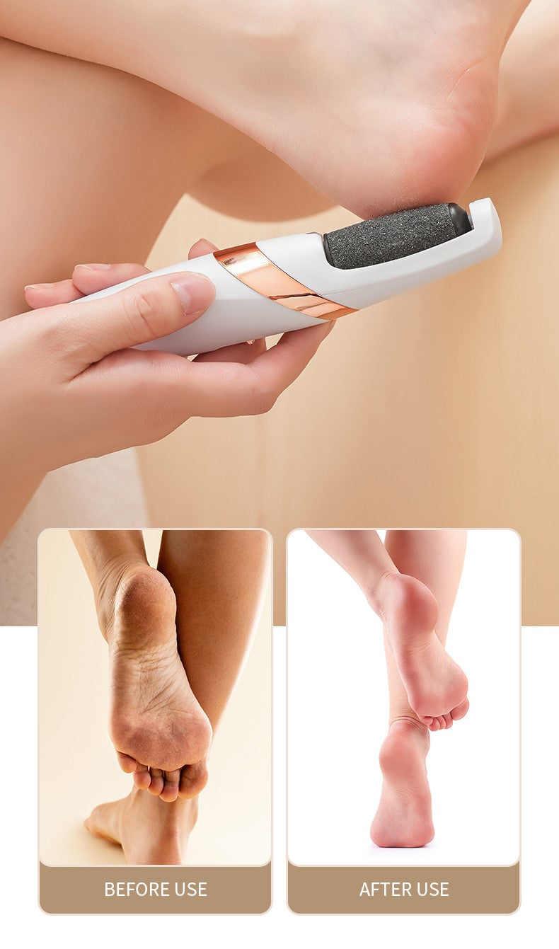 Pedivellea™ | Spüren Sie sanfte Geschmeidigkeit bei jedem Schritt