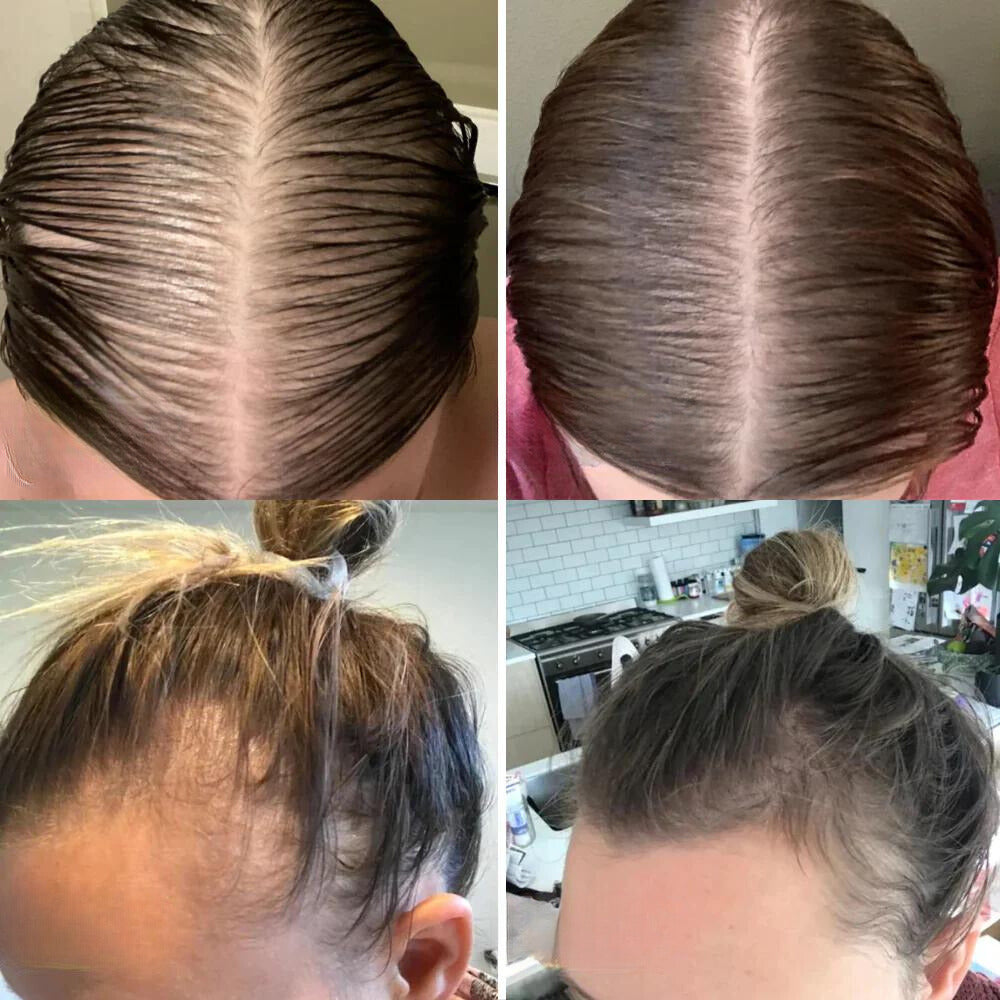 HairGrow™ - Vogany Natürliches Haarwuchsöl (50% RABATT)