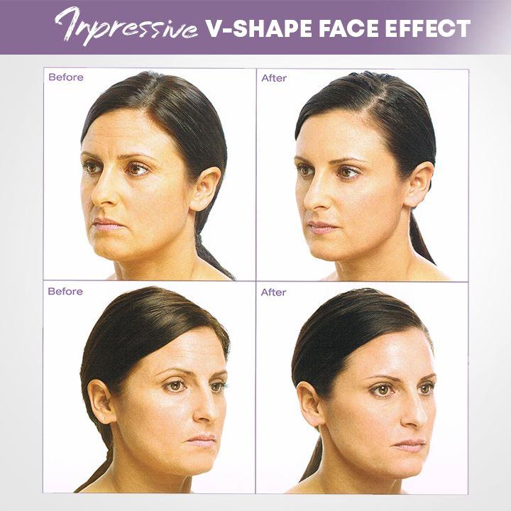 Unsichtbares Face Lifter Tape (40 Stück)